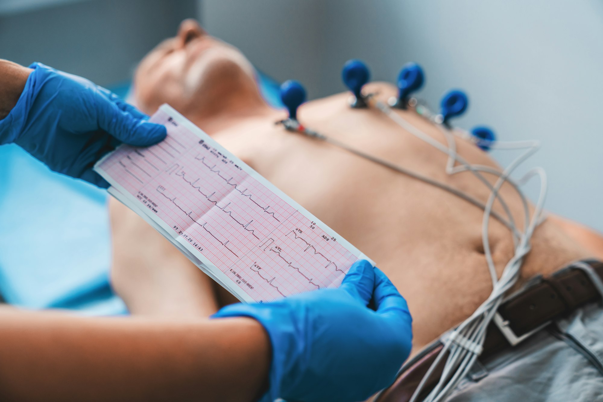 Electrocardiogram, ECG in hand. Cardiogram printout on male patient background