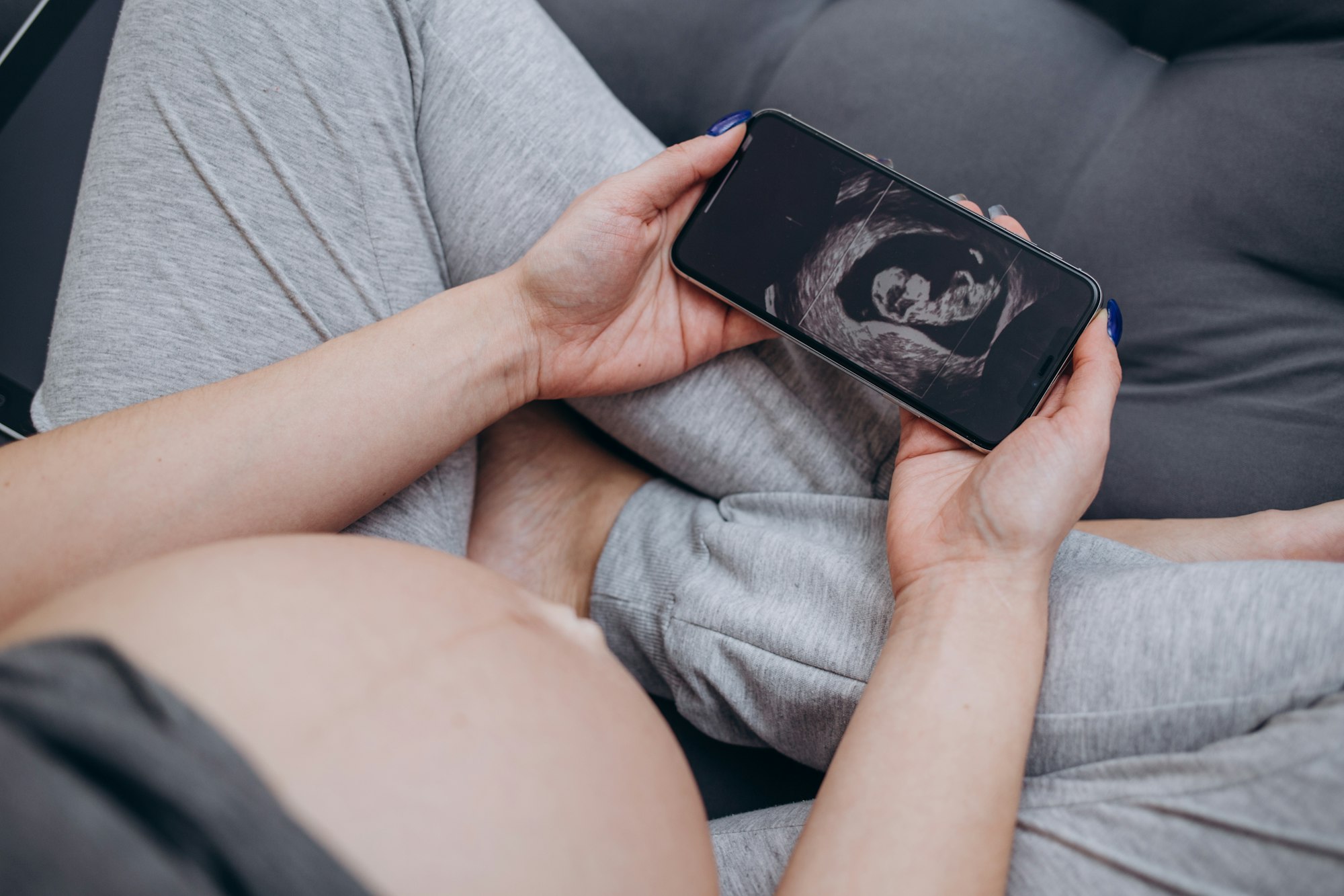 Pregnant woman looking at ultrasound scan of baby, close up of scan